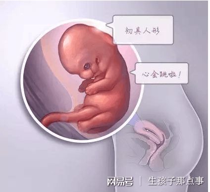 染色体易位案例